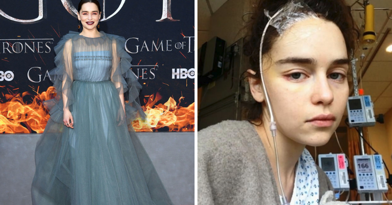 'Game of Thrones' star Emilia Clarke shares never-before-seen photos of herself after brain surgery