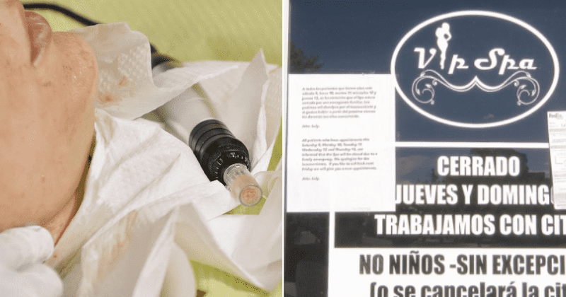 Albuquerque spa clients contract HIV following 'vampire facial', health dept urges all customers to get tested