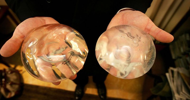 Breast implants linked to rare cancer will stay in market, but with bolder warnings, announces FDA