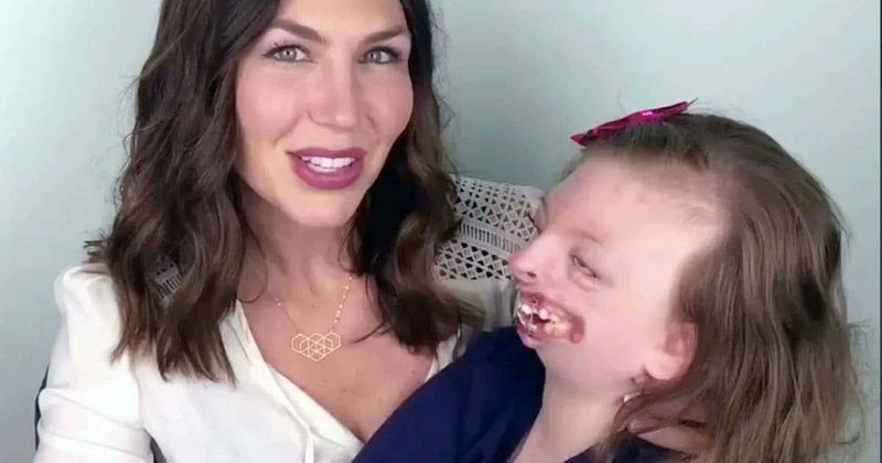 Sophia Weaver, 10-year-old who was bullied for facial deformities and inspired support for disabled children, passes away
