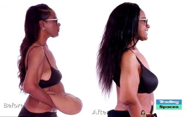 Melanie Mason's transformation (TLC)