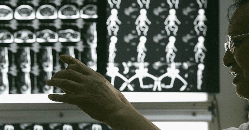 China forcibly harvesting organs from its dissidents in a 'kind of genocide': Report