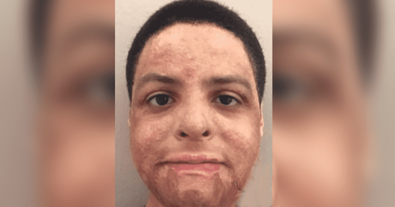 'I made a mistake': School principal breaks down in court after student suffered 3rd-degree burns in botched chemistry experiment