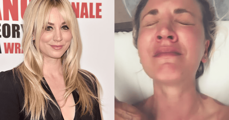 Kaley Cuoco shares painful cupping and scraping therapy video after her body 'shut down from complete overuse'
