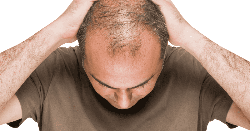 Has a cure for baldness been found? Scientists use stem cells to grow hair in breakthrough research