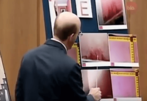 Medical examiners offered contrasting opinions (Source: YouTube)