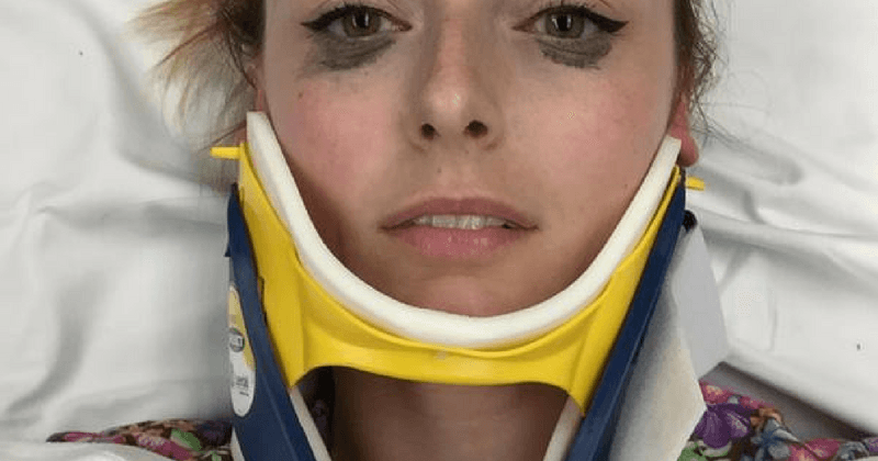 Woman involved in a horrible accident all praise for eyeliner for staying put