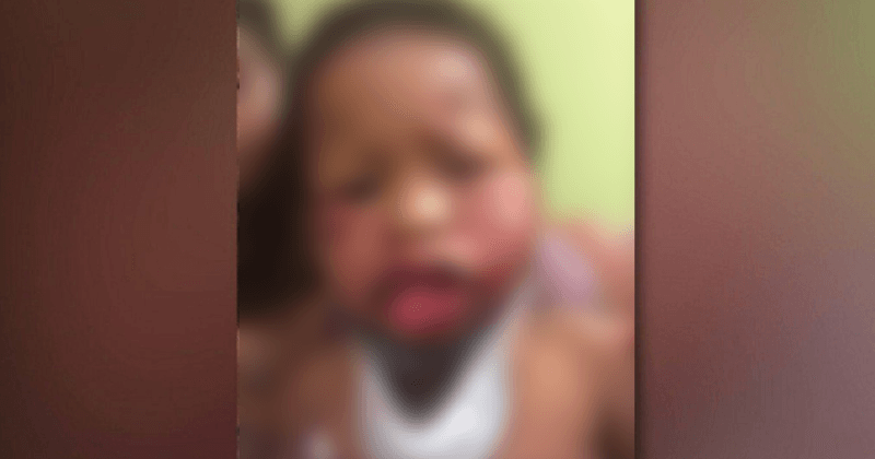 Indiana mom blames daycare for badly beaten, hospitalized toddler while daycare blames it on 2-year-old