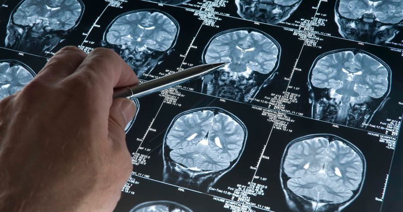 13-year-old considered as a 'miracle child' after surviving seven skull fractures
