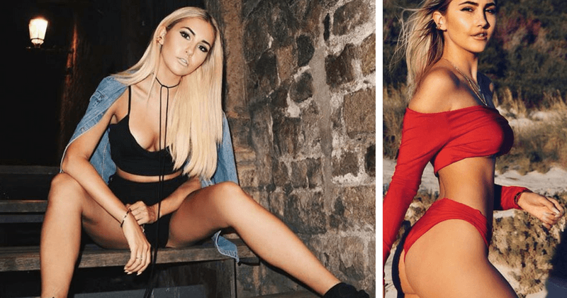 Gorgeous 23-year-old model ends up looking like "The Joker from Batman" after horrifying pitbull attack
