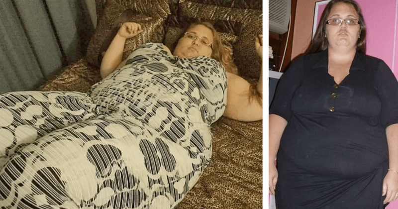 Instagram star loses 88 kg after surgery, shares absolutely stunning photos of transformation