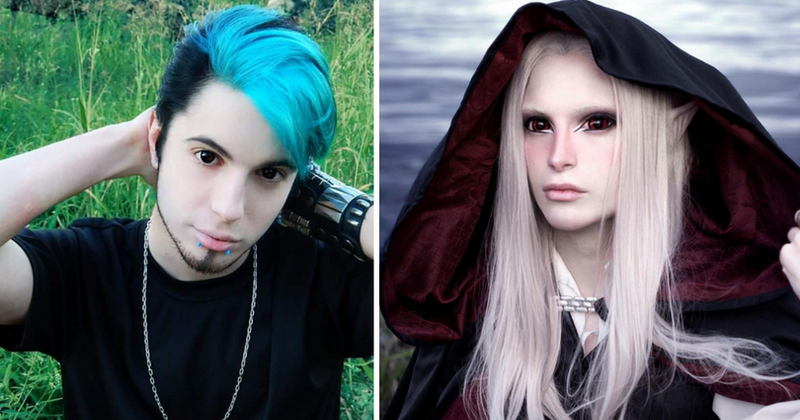 $60,000 worth of surgeries later, 'human elf' says he will have his Adam's apple reduced and fangs added