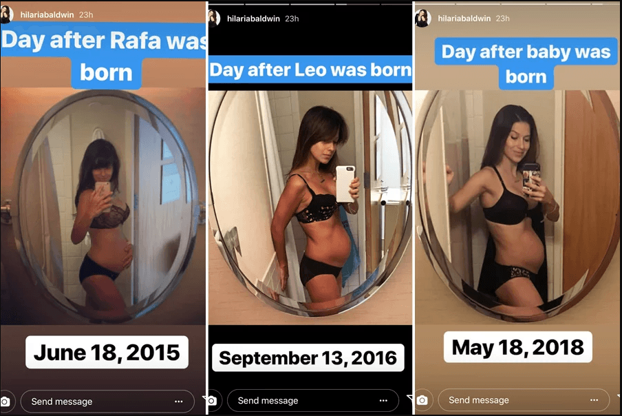 Hilaria shared photos after her past pregnancy (Instagram Story)