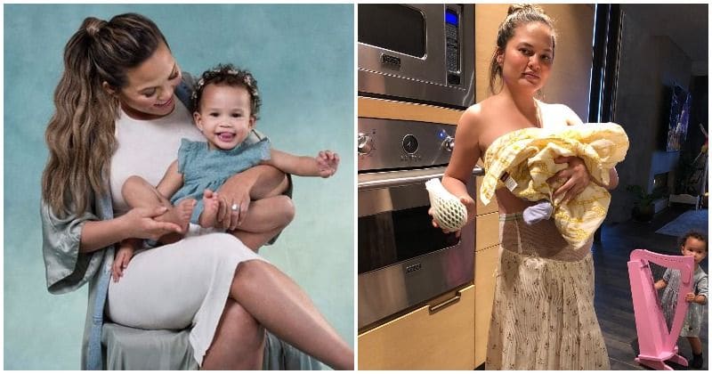 Chrissy Teigen opens up about the scars of childbirth that few women talk about