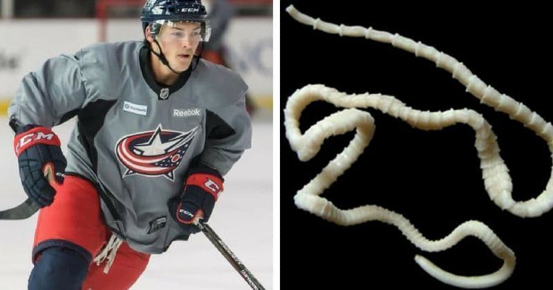 Freaky: Giant 25-inch tapeworm lived inside NHL prospect for a whole year