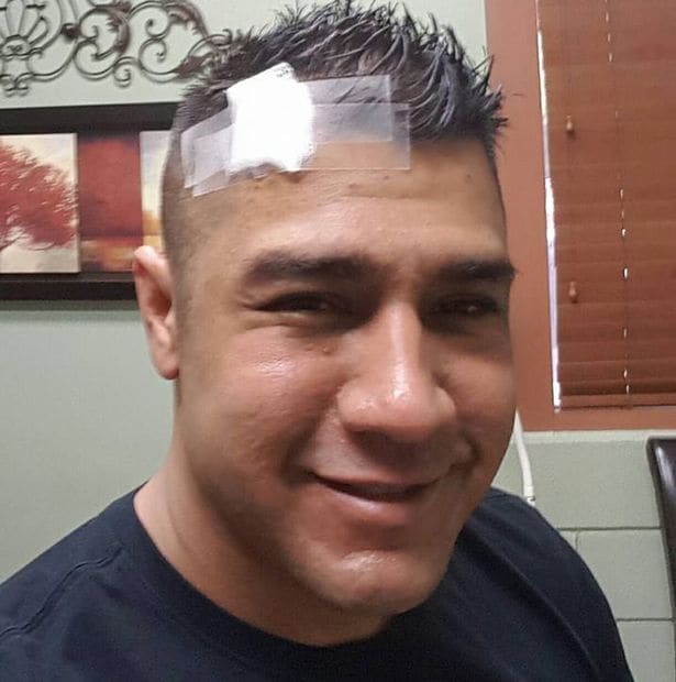 He spent four months in a coma after being attacked by his ex-girlfriend (Facebook)