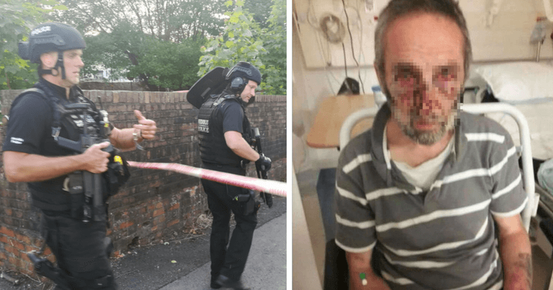 Man suffers horrifying injuries to face after machete attack that sparked 48-hour armed siege