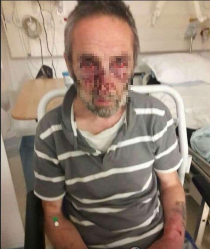Nigel Davies was attacked by a man with a machete (Twitter)