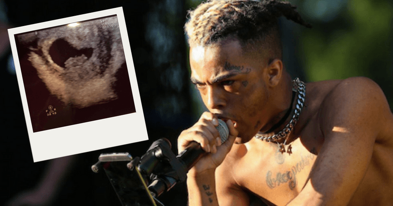 XXXTentacion's mother posts photo of ultrasound revealing the late rapper was having a baby