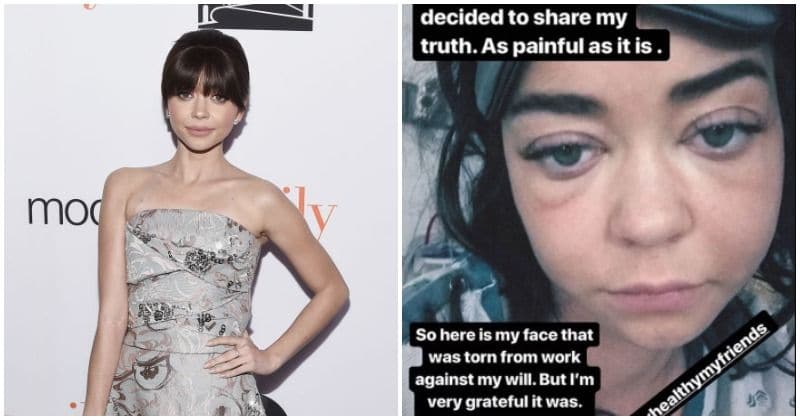 Sarah Hyland shares 'painful' photograph of her face after she is hospitalized amid health battle
