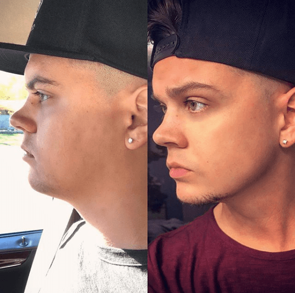 Before and after shot of Tyler Baltierra (Source: tylerbaltierramtv, Instagram)