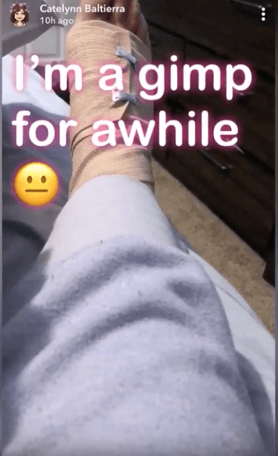 Catelynn Lowell's foot injury (Source: YouTube)