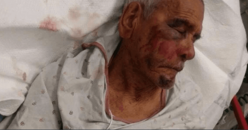 92-year-old beaten up by mother and four others with a brick for bumping into her daughter
