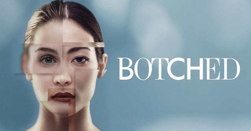 Season finale of 'Botched' features a transgender who wants to fix his dented chest