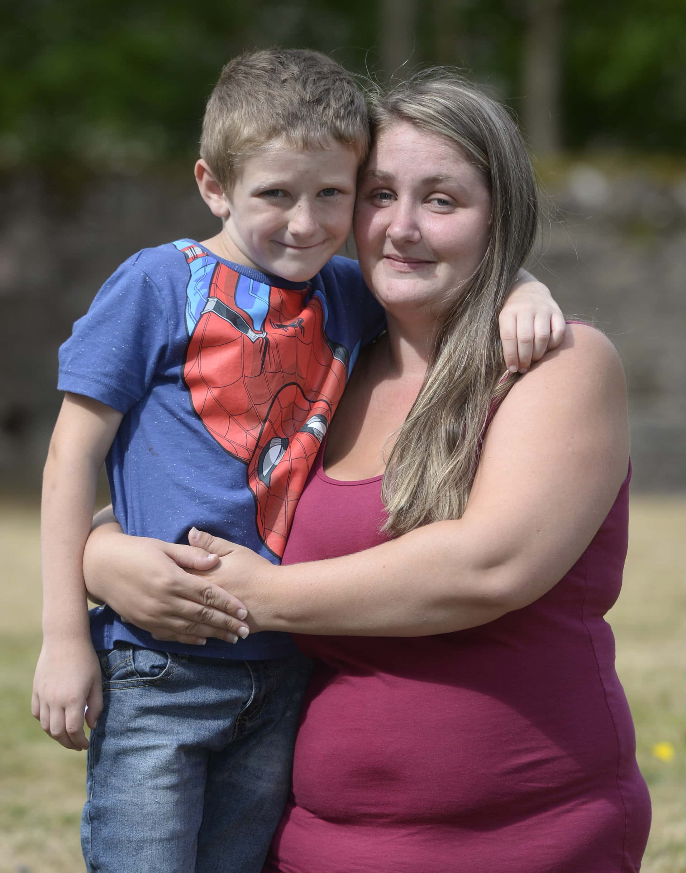 His mum Paula, 26, says the condition runs on her dad's side of the family (Image: SWNS)