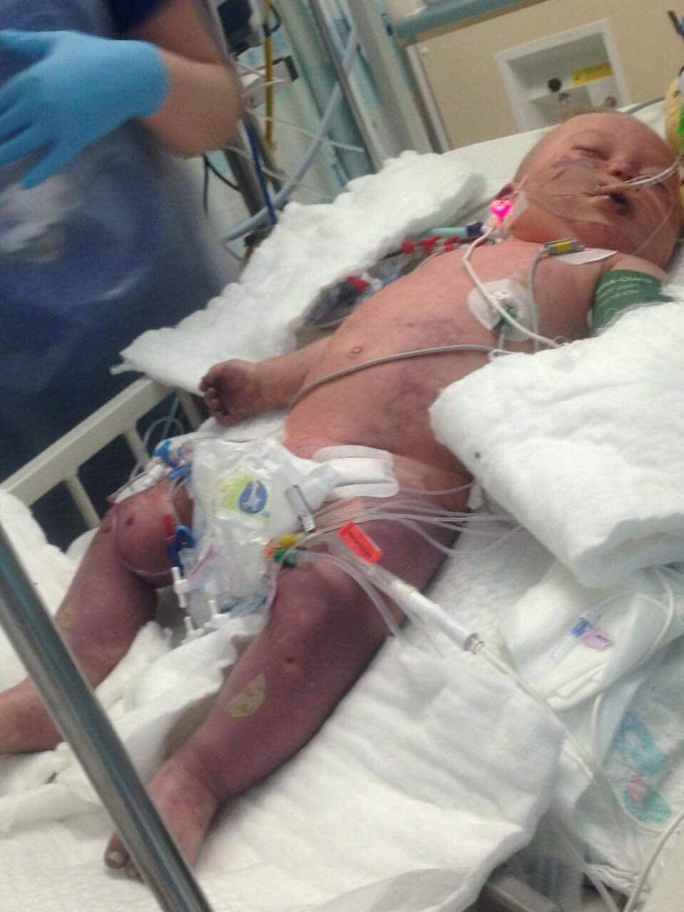 Taylor Lewsley pulled through after 17 days in a coma — but had to have both legs and all his fingers amputated (Image: SWNS)