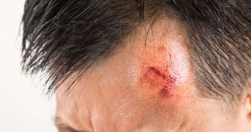 Footage of man being hit in face by car shows the dangers of ridiculous #InMyFeelings internet challenge