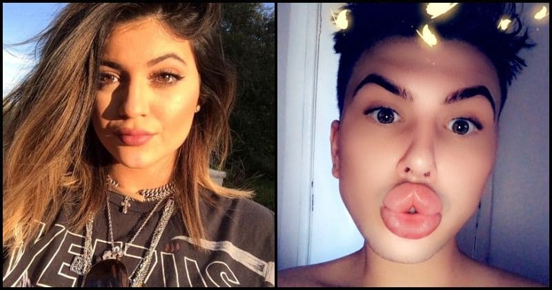 Kylie Jenner's obsessive fan spends £14,000 for a pout 'like her' but they burst out