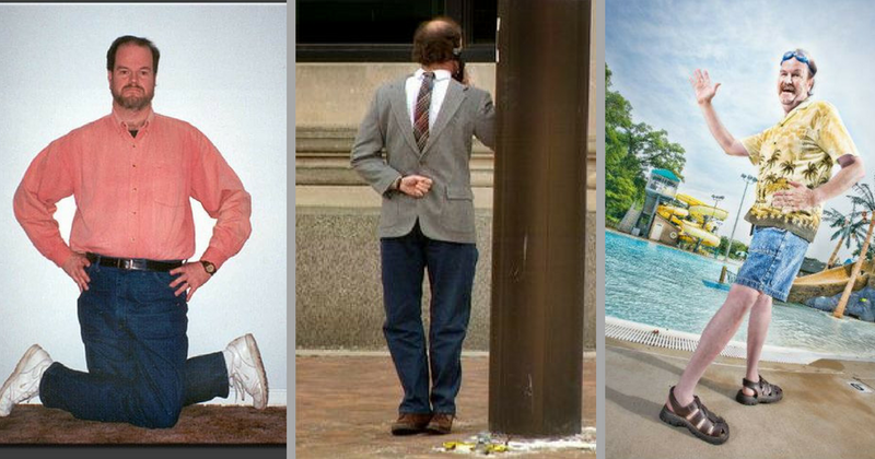 For Moses Lanham, the ability to twist his feet backward 180 degrees and walk earned him two Guinness world records!