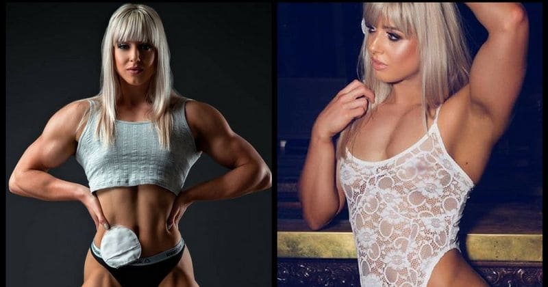 Bodybuilding champion Zoey Wright who suffers from bowel disease reveals she's getting ostomy bag removed