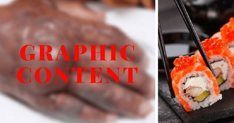 Man has forearm amputated after catching bacterial infection from eating sushi