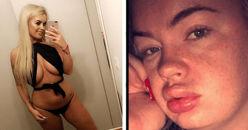 EuroMillions winner Jane Parks recalls how botched Brazilian bum lift procedure left her fighting for life