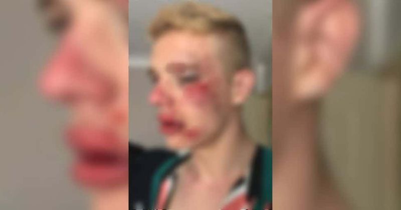 Man, 22, left with horrific injuries after thugs yelling 'gays should die' stamp on his face in brutal homophobic attack
