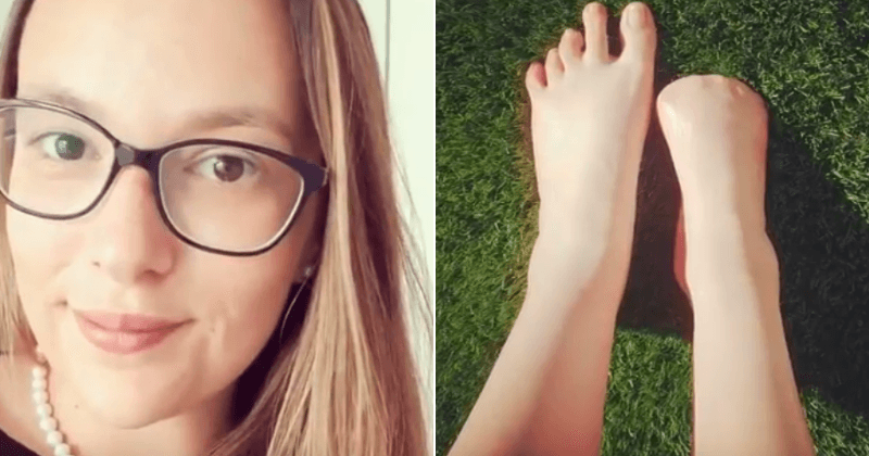 Woman loses all her toes after picking up bone-eating infection from Thailand's popular fish pedicure during holiday