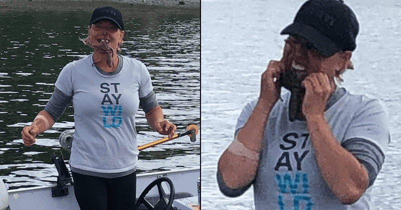 Woman puts venomous octopus on face for photo op, gets bitten twice and ends up with a bleeding and swollen chin