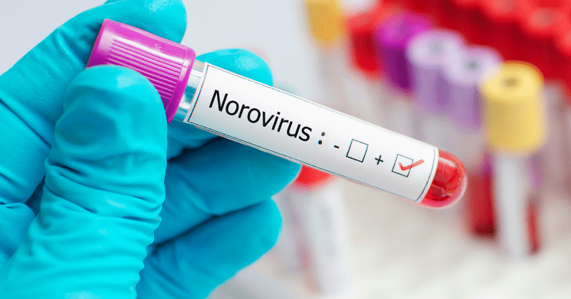 Norovirus kills 200,000 annually, but now armed with just a smartphone scientists can detect tiny amounts of the pathogen