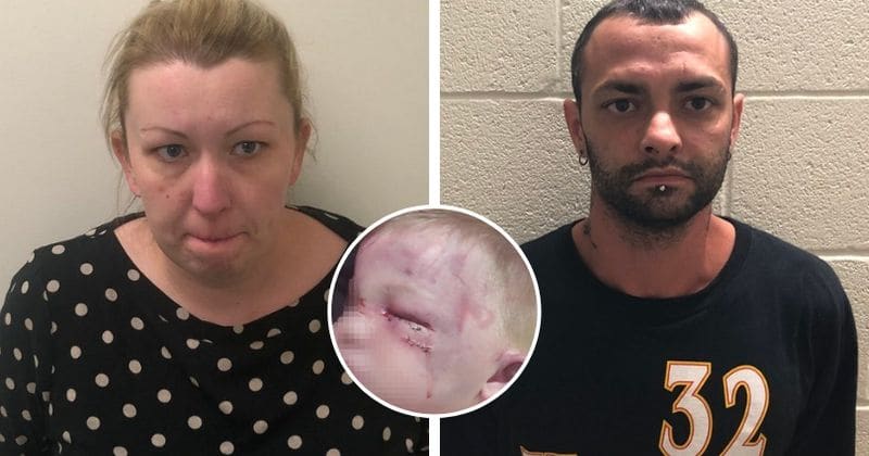 3-year-old with speech disorder punched and whipped with a dog leash by mother and her boyfriend