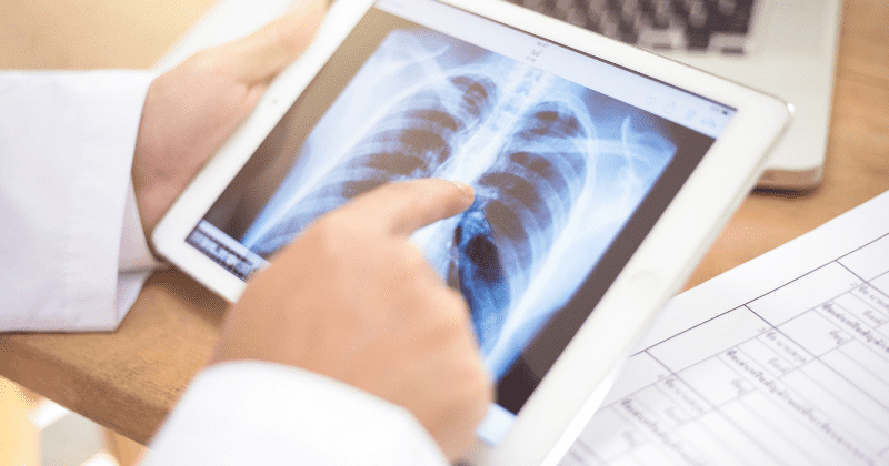 Over 100,000 cancer patients getting diagnosed too late each year due to severe staff shortage