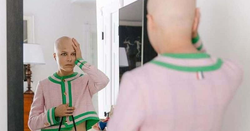 Selma Blair bares her butt and bald head in semi-nude photo after undergoing chemotherapy for multiple sclerosis