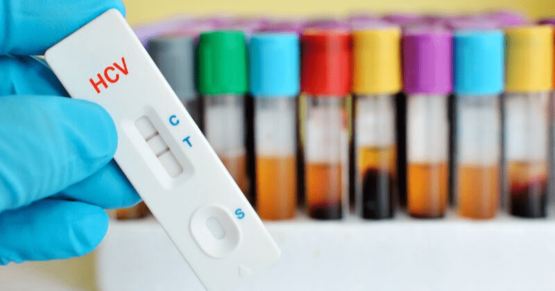 Kidneys infected with Hepatitis C virus work just as well as uninfected kidneys after transplant indicating they are safe to use