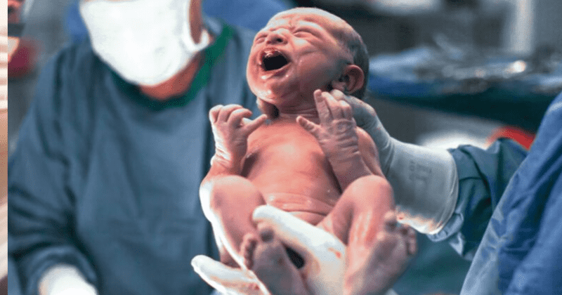 Cesarean babies have high levels of hospital bugs in their guts, unlike vaginally-born babies who get their bacteria from mothers
