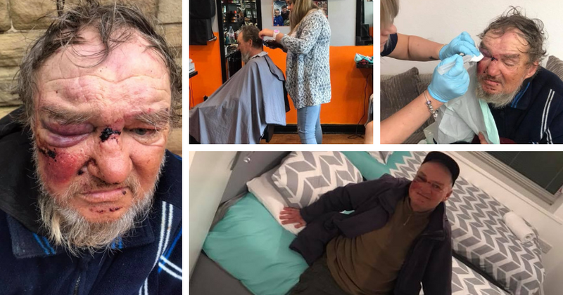 Homeless man viciously beaten by teen thugs gets a new lease on life thanks to kind-hearted locals