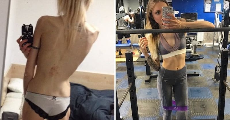 Severely anorexic woman who plummeted to 5st builds self-transformation fitness program and is now an inspiration to many!