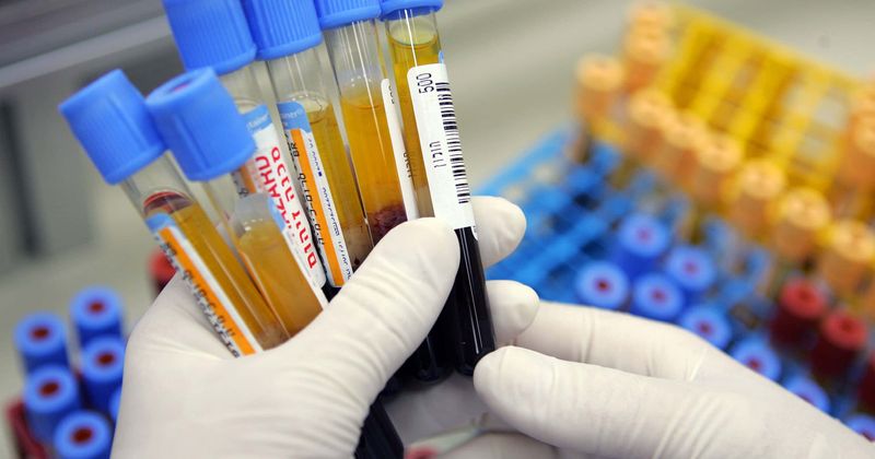 All newborns must be tested for high cholesterol to detect rare genetic disease that can cause premature death: Experts
