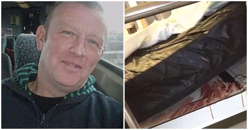 West Yorkshire man had to take HIV and Hepatitis tests after spending night on hospital bed smeared with another patient's blood