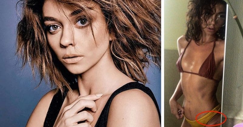 'Modern Family' star Sarah Hyland flaunts kidney transplant scar while sporting bikini in brave post